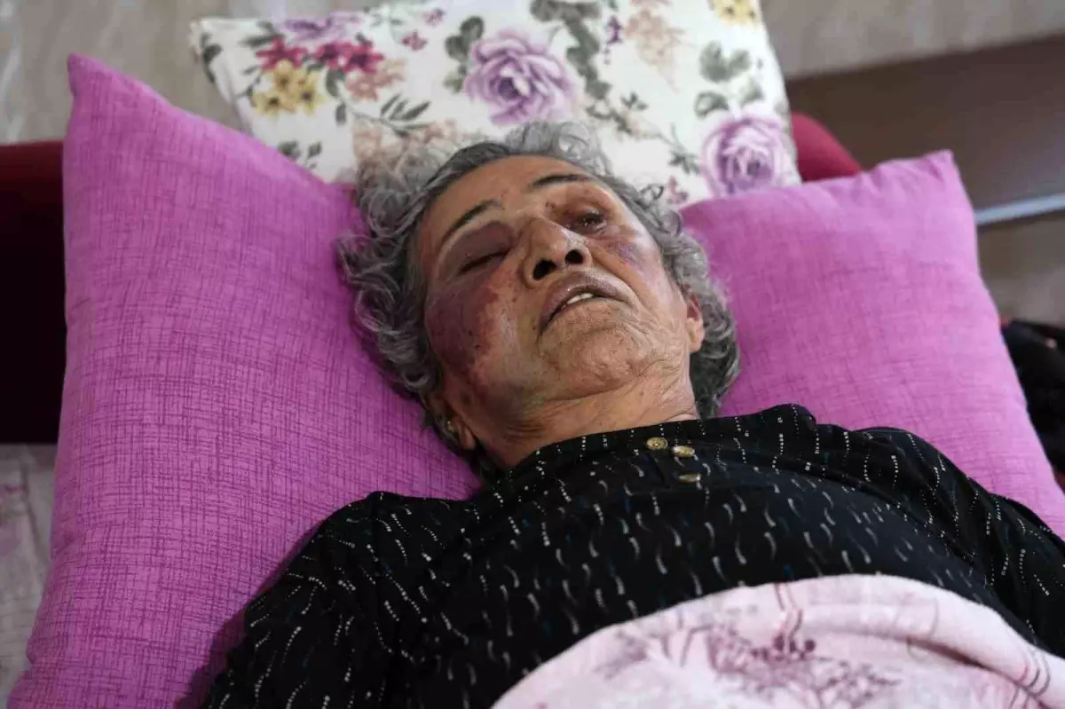 Adana’da Yüzük İhtirası: Yaşlı Kadın Darp Edildi
