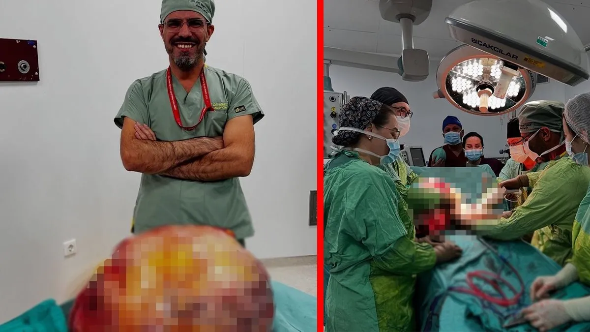 Karın ağrısı şikayetiyle gitti: Doktorlar görünce şaştı kaldı!